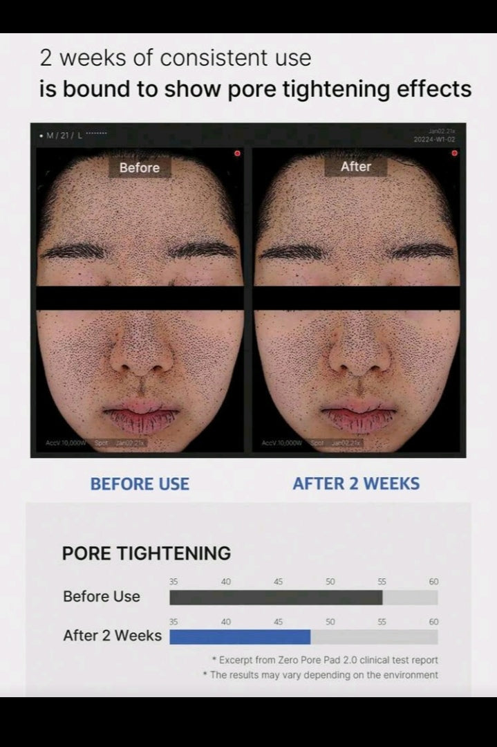 Zero Pore Pad 2.0